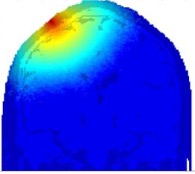 Monte Carlo simulation of photon propagation in the brain